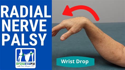 the hand drop test|finger drop without wrist.